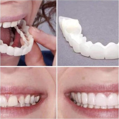 Snap On Smile Veneers Moldable False Artificial Braces Teeth Kits For Men And Women